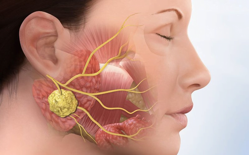 Nhổ răng khôn hàm trên có nguy hiểm không?