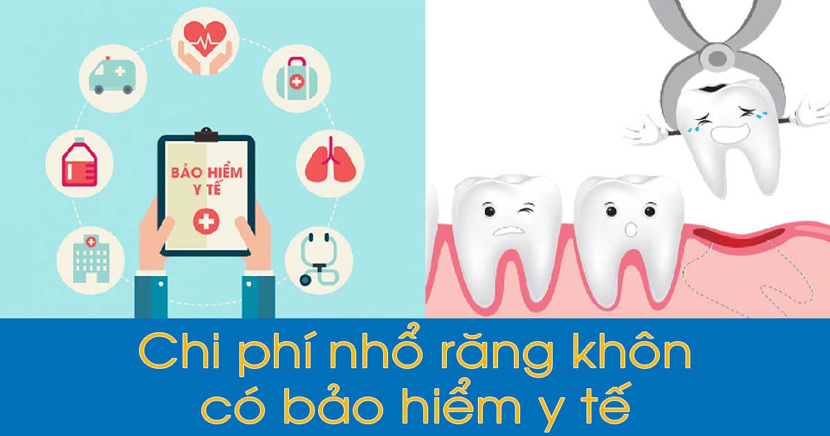 Chi phí nhổ răng khôn có bảo hiểm y tế