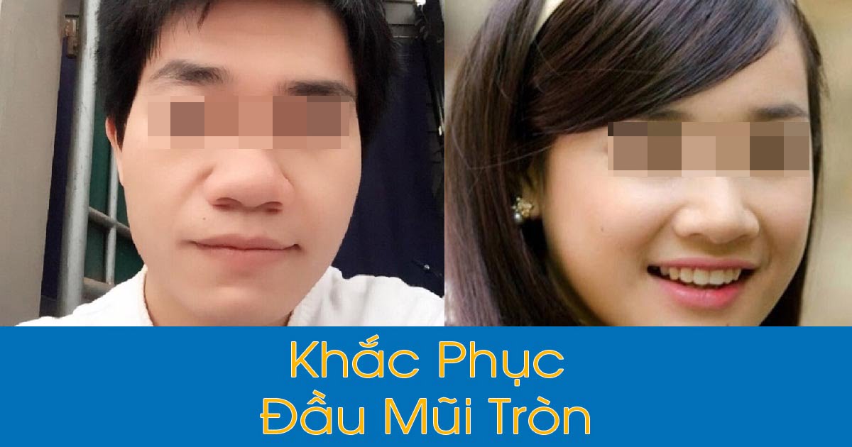 Đầu mũi tròn nhiều thịt