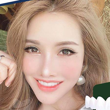 78Win Dental - Nụ Cười Rạng Rỡ, Tự Tin Mỗi Ngày!