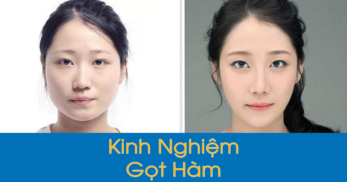 Kinh nghiệm Gọt Hàm