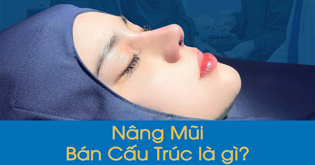 Nâng Mũi Bán Cấu Trúc