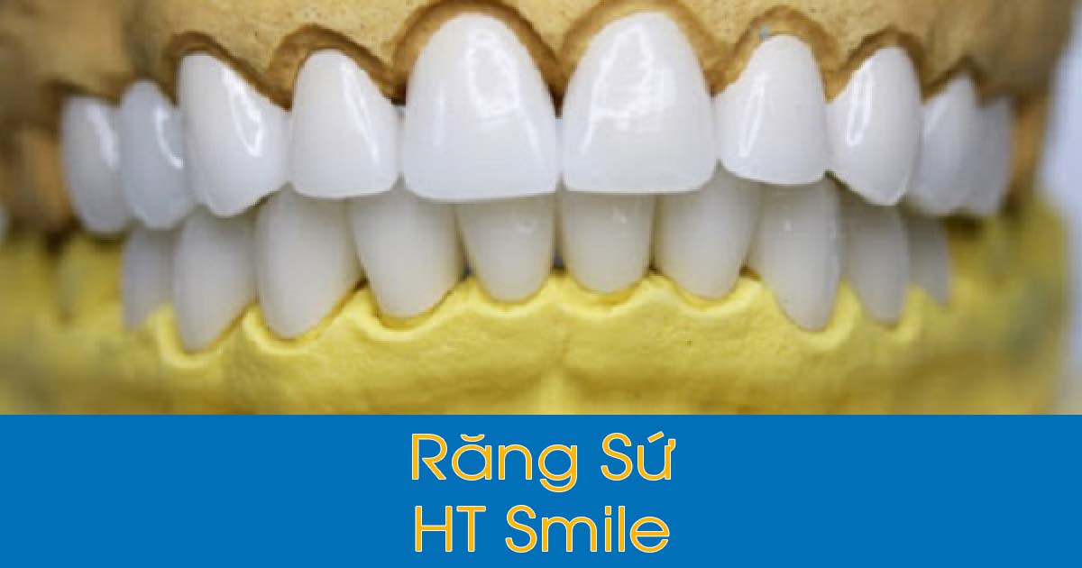 Răng sứ HT Smile có tốt không