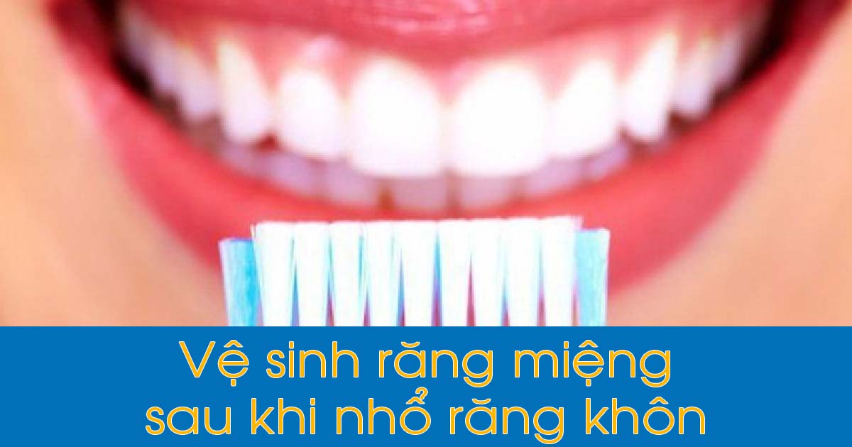 Cách vệ sinh răng miệng sau khi nhổ răng khôn