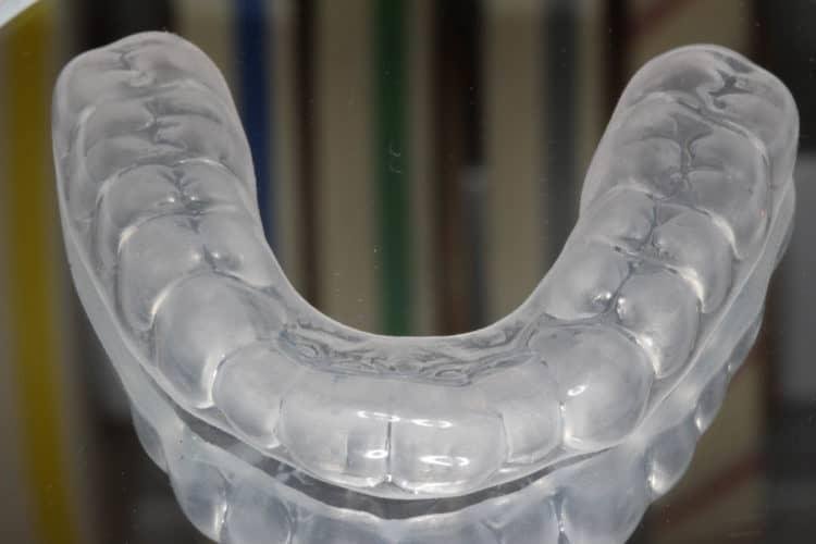 bảo vệ răng miệng