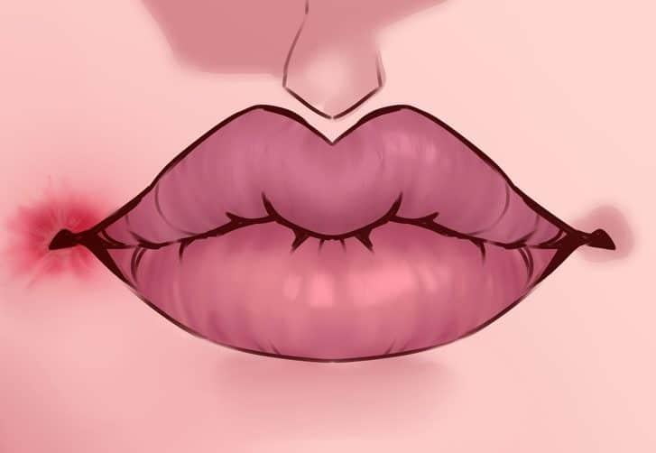 Điểm danh 8 dấu hiệu trên môi cho bạn biết tình hình sức khỏe