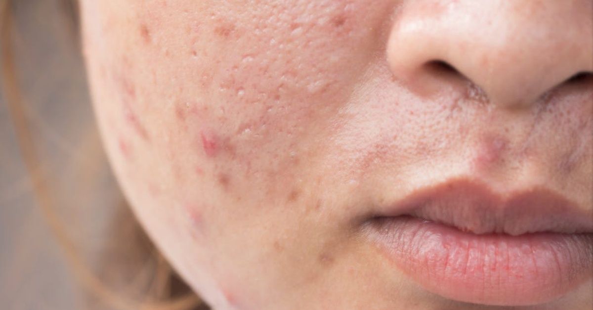 Cách tẩy trang đúng cách