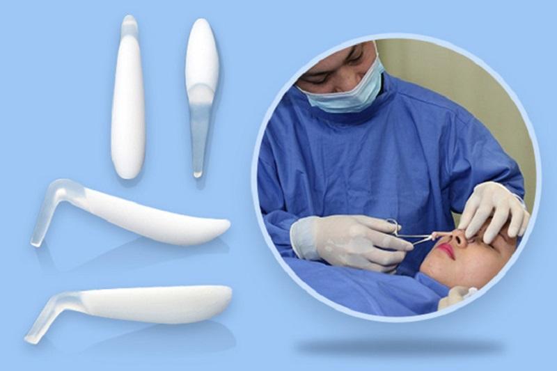 Sụn tự thân tương thích cao với cơ thể