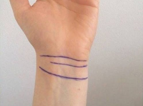 Đường vân cổ tay thứ ba