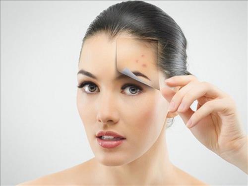 vùng trán bất ngờ xuất hiện nhiều mụn