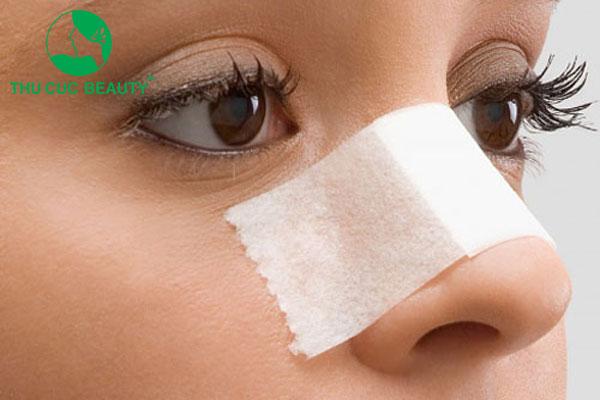 dùng nẹp mũi định hình