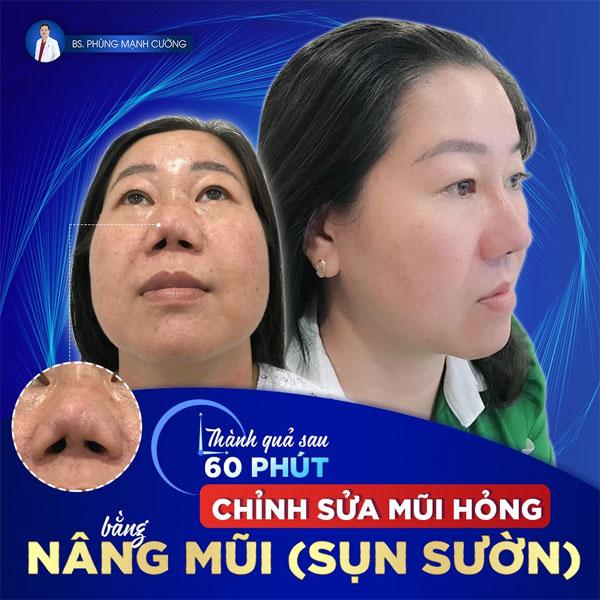 nang mui sun suon 2
