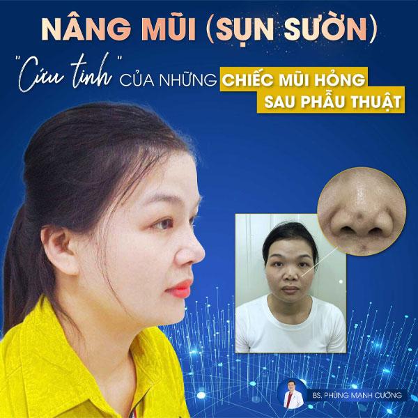 nang mui sun suon