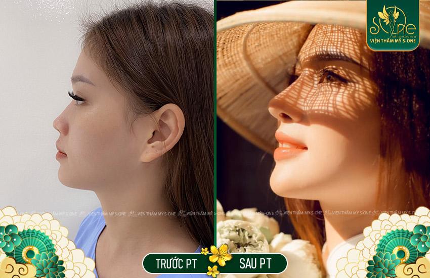 Nha Khoa Thẩm Mỹ Quốc Tế – Smile Dental | Bọc Răng SỨ