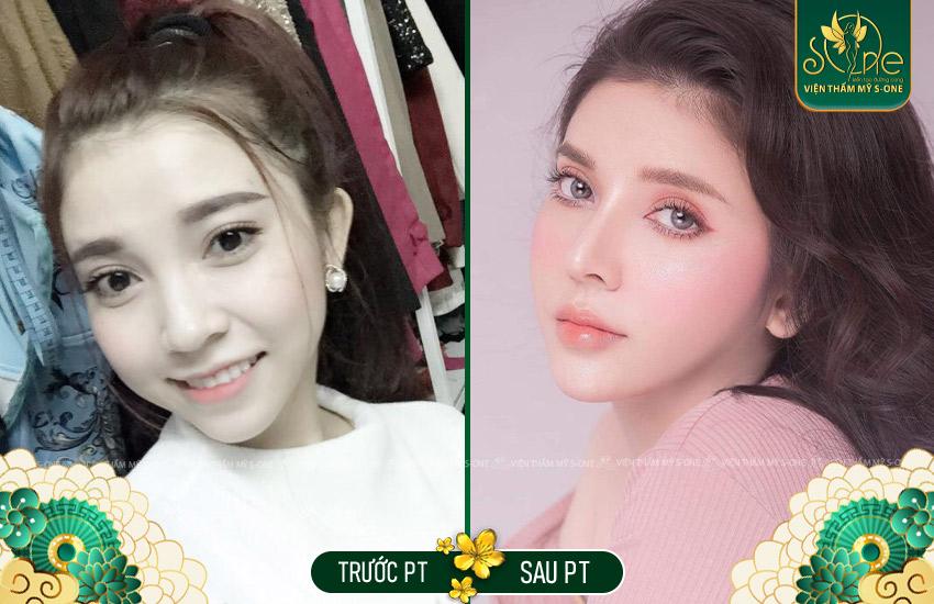 Nha Khoa Thẩm Mỹ Quốc Tế – Smile Dental | Bọc Răng SỨ