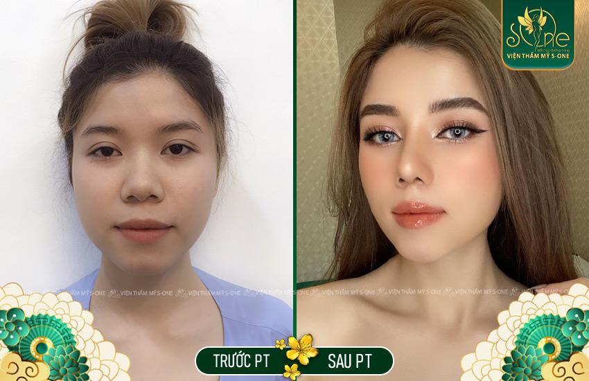 Nha Khoa Thẩm Mỹ Quốc Tế – Smile Dental | Bọc Răng SỨ