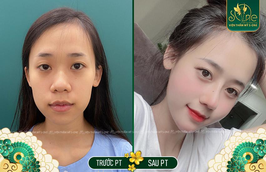 Nha Khoa Thẩm Mỹ Quốc Tế – Smile Dental | Bọc Răng SỨ