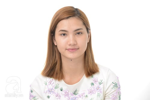 Hai bên lông mày không cân xứng