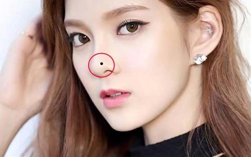 Nốt ruồi ở mũi
