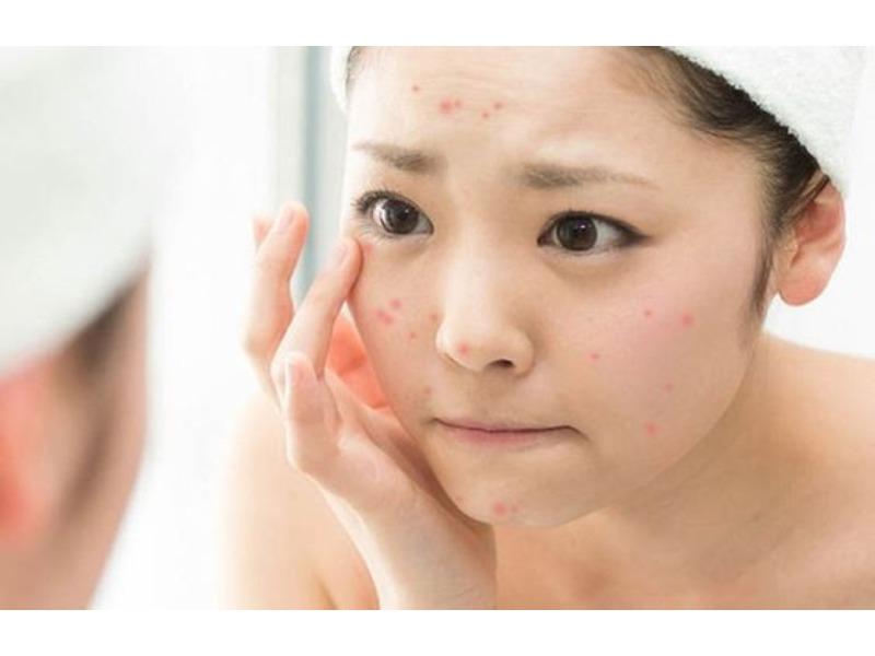 Hãy chú ý tới những thành phần gây kích ứng da