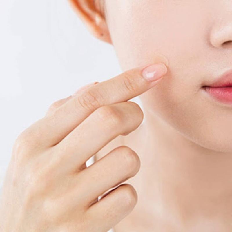 Sử dụng miếng dán mụn có thể hỗ trợ điều trị mụn nhọt an toàn