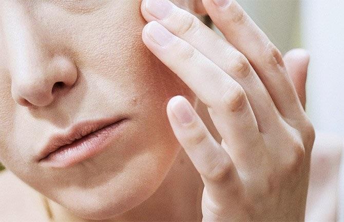 Nhiều nguyên nhân có thể làm da khô