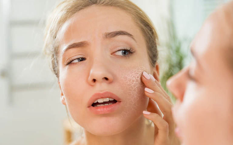 Sử dụng sai loại kem chống nắng có thể kích ứng cho da