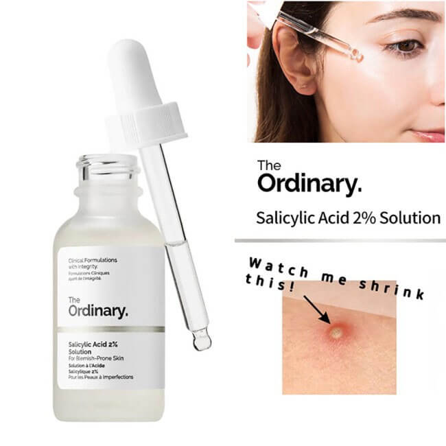 Sản phẩm The Ordinary là một trong những sản phẩm hỗ trợ điều trị mụn tốt nhất