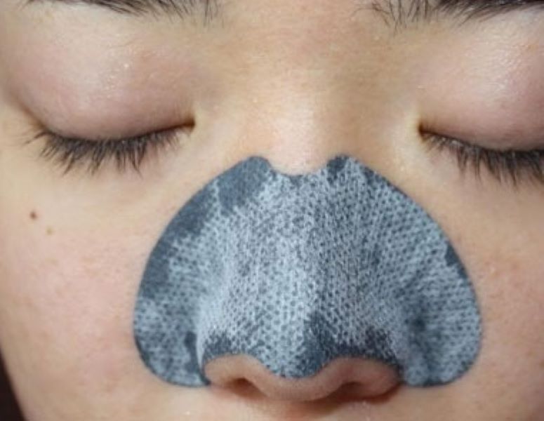 Miếng dán lột mụn có thể làm sạch mụn đầu đen trên da