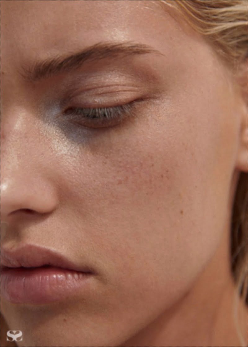 word-image-236-6 Làn da khô, không được căng bóng