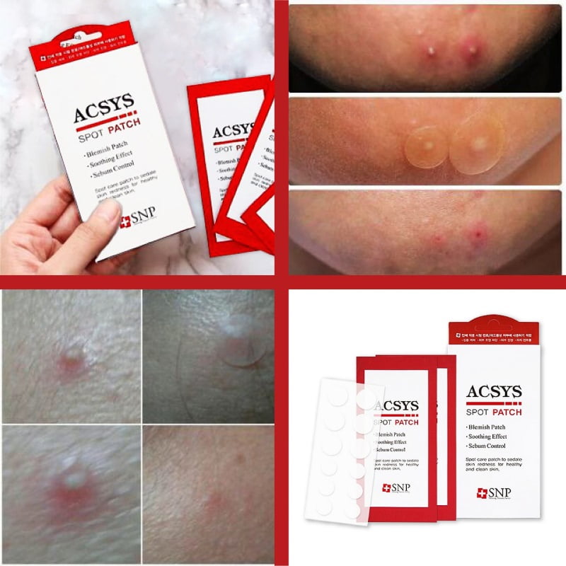 Miếng dán mụn 72 tiếng SNP Acsys Spot Patch