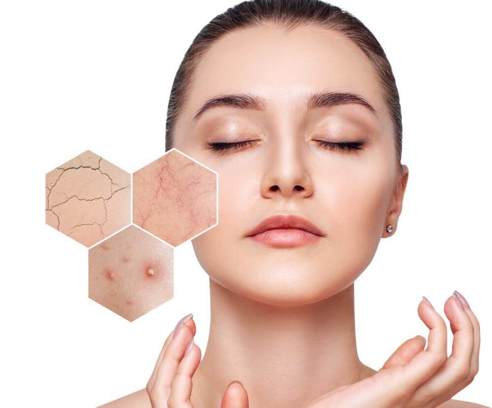 Da nhạy cảm có nhiều vấn đề hơn bạn nghĩ