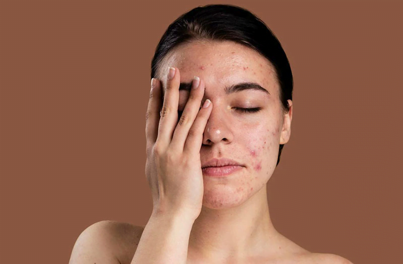 Da bạn có phải da nhạy cảm