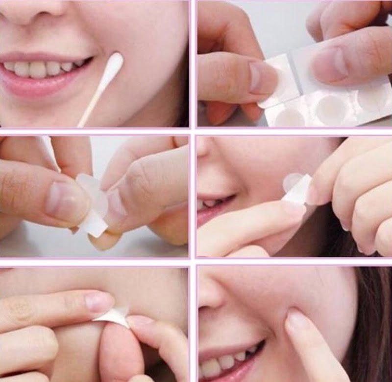 Các bước sử dụng miếng dán mụn an toàn