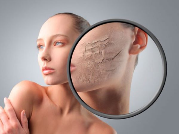 Da khô, căng, và xỉn màu là những dấu hiệu bị thiếu nước