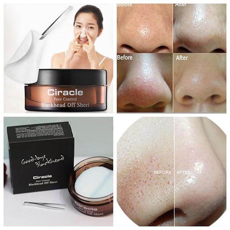 Sản phẩm đến từ thị trường Hàn Quốc, Goodbye Blackhead Ciracle