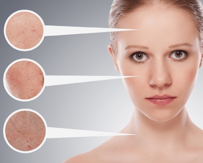 word-image-69 Lạm dụng BHA sẽ làm da yếu đi