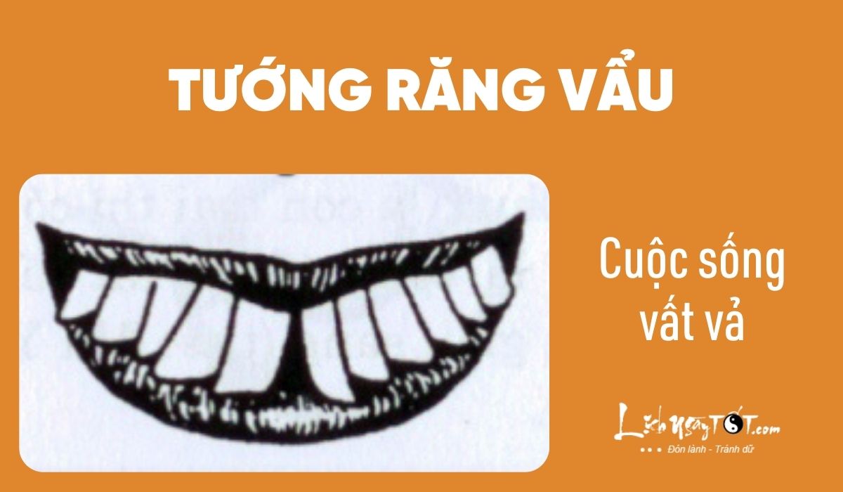 Xem nhân cách qua tướng răng - Răng vẩu